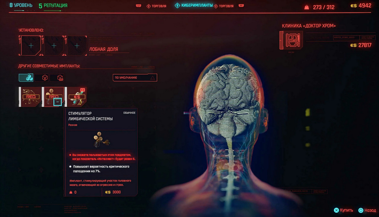 Neuralink Илона Маска впервые имплантировала нейрочип в мозг человека - фото 1