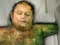 Эбола, да не та: самые страшные болезни в играх. Часть 2 - изображение 7 Эбола, да не та: самые страшные болезни в играх. Часть 2 - фото 7