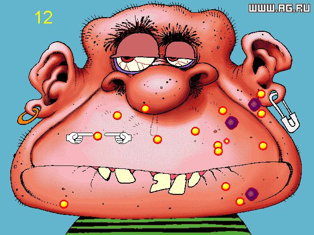 Acne Attack! - кадр 2