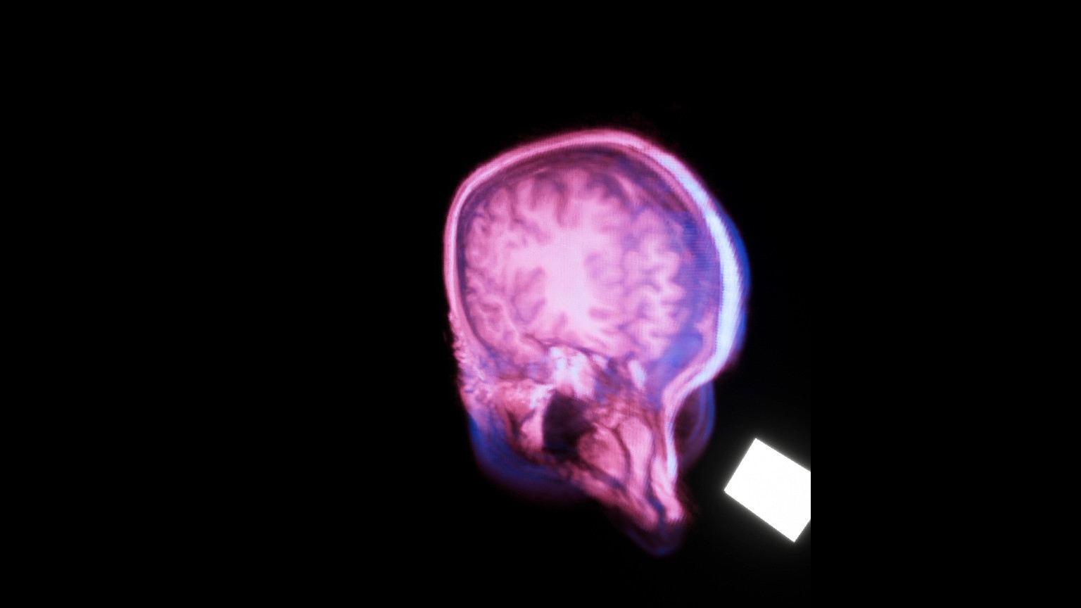 MRI VR (itch) - кадр 1