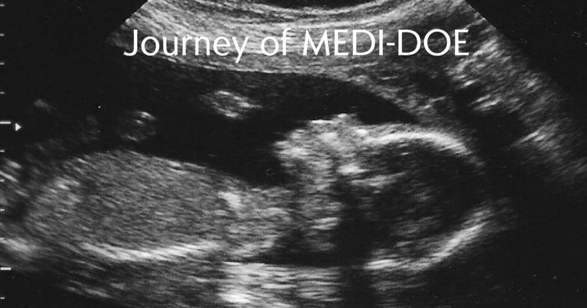 Journey of MEDI-DOE (itch) - кадр 1