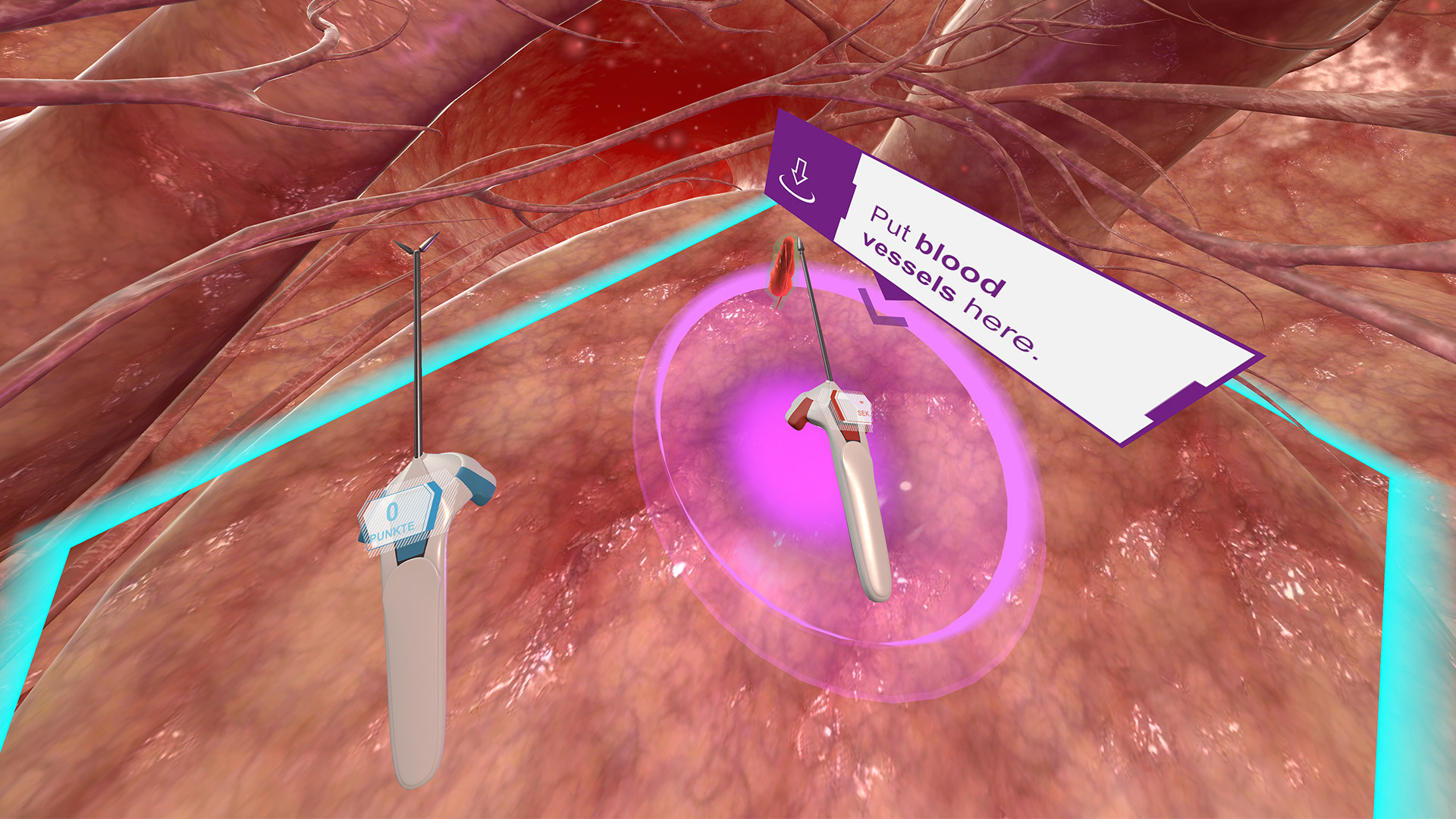 B. Braun Future Operating Room - кадр 5