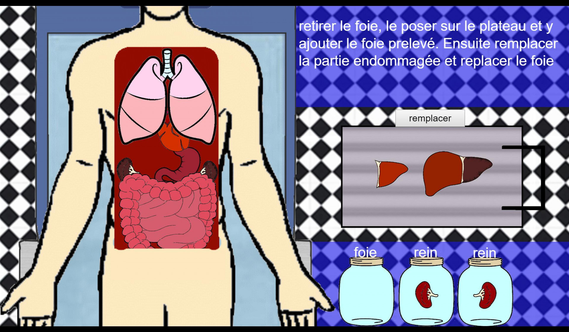 EMC organ donation (itch) - кадр 2