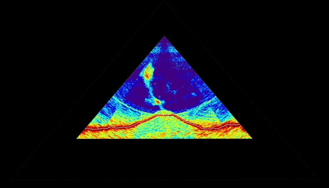 VolcanoExplano (itch) VolcanoExplano (itch)