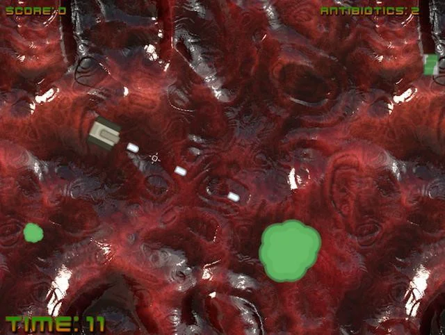 Frontal Sinus (itch) Frontal Sinus (itch)