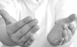 Hands (itch)