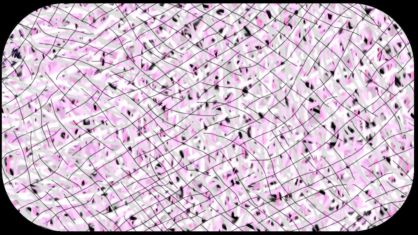 Juxtaposed Crazy Lines (itch) Juxtaposed Crazy Lines (itch)