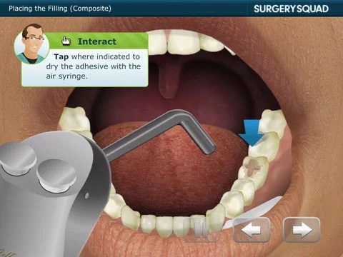 Surgery Squad's Dental Filling Surgery Squad's Dental Filling