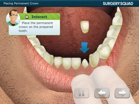 Surgery Squad's Dental Crown Surgery Squad's Dental Crown