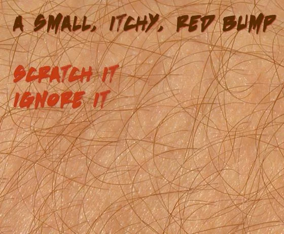 itch itch