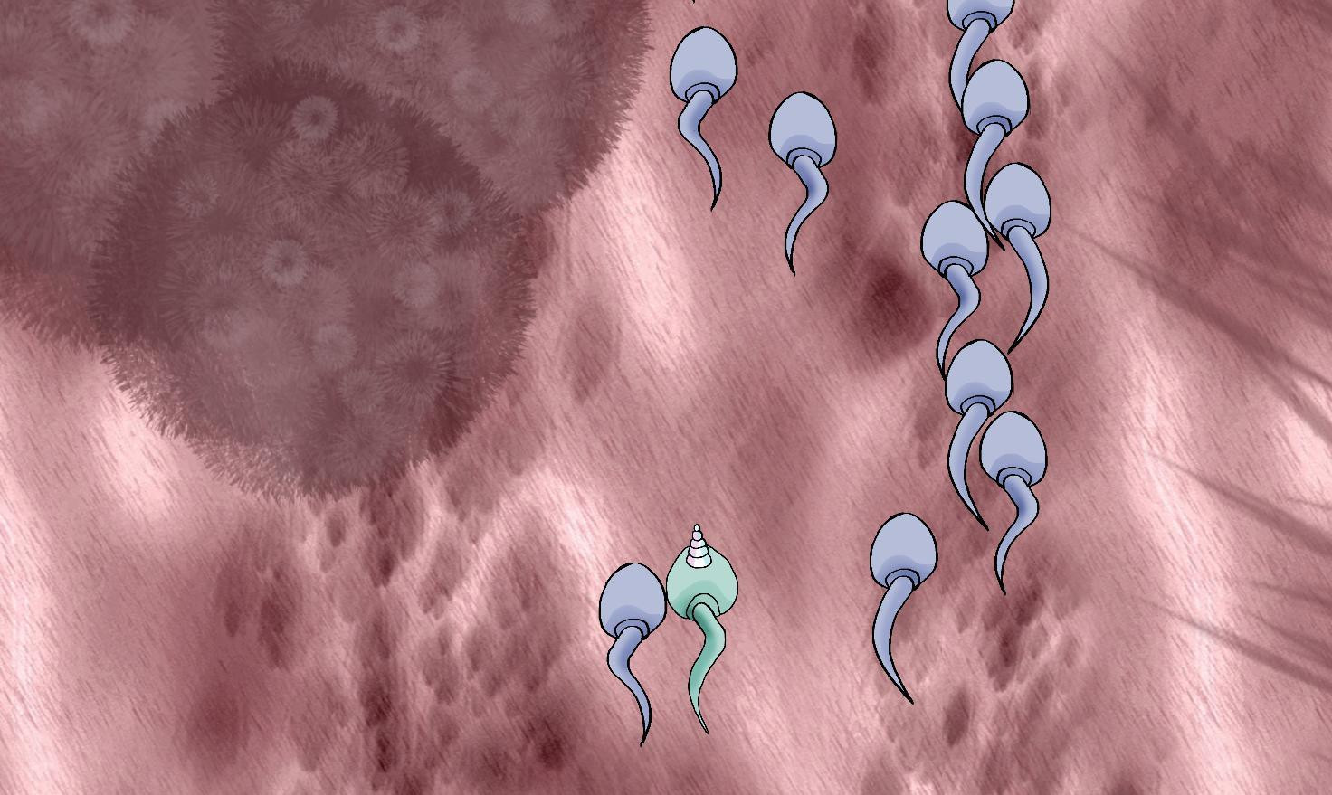 Spermicorn (itch) Spermicorn (itch)
