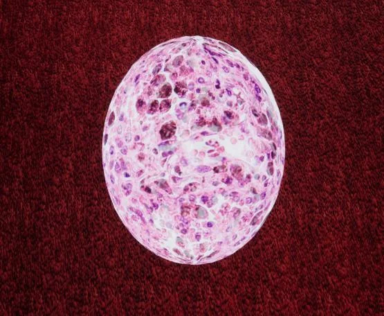 Pathogenesis (itch)