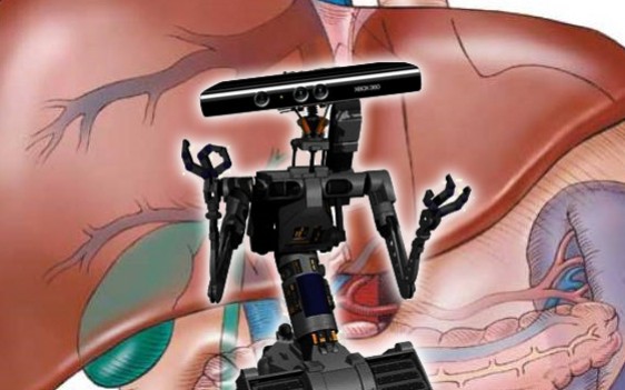 Kinect будет спасать жизни - изображение обложка