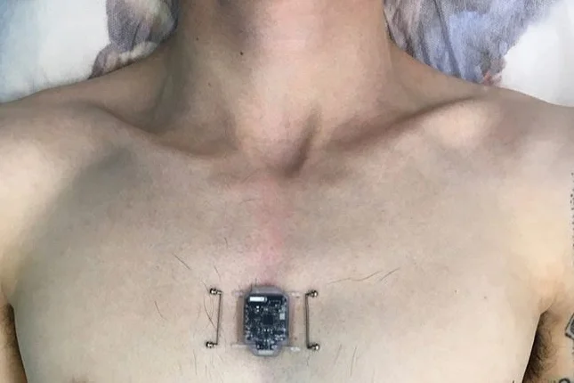 Программист из России вживил себе в грудь чип-компас - фото 2