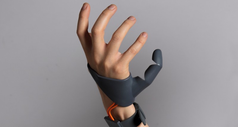 Дизайнер разработала протез шестого пальца - изображение обложка